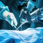 A Cirurgia Robótica Ginecológica é Mais Segura do que a Cirurgia Tradicional_
